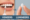 veneers vs lumineers