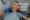Best Root Canal Treatment in Dubai