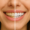 Best Teeth Whitening Treatment in Dubai